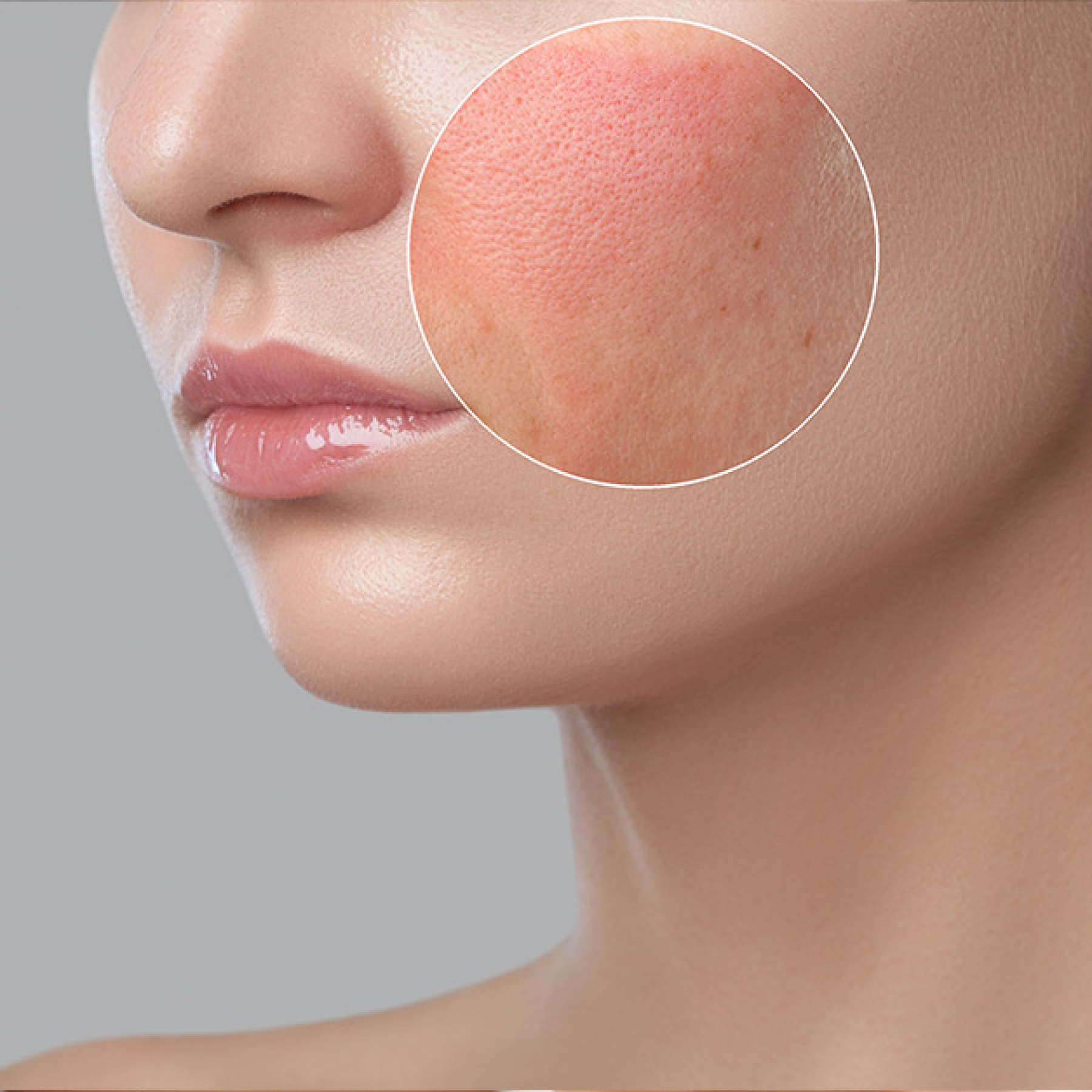 female-face-rash